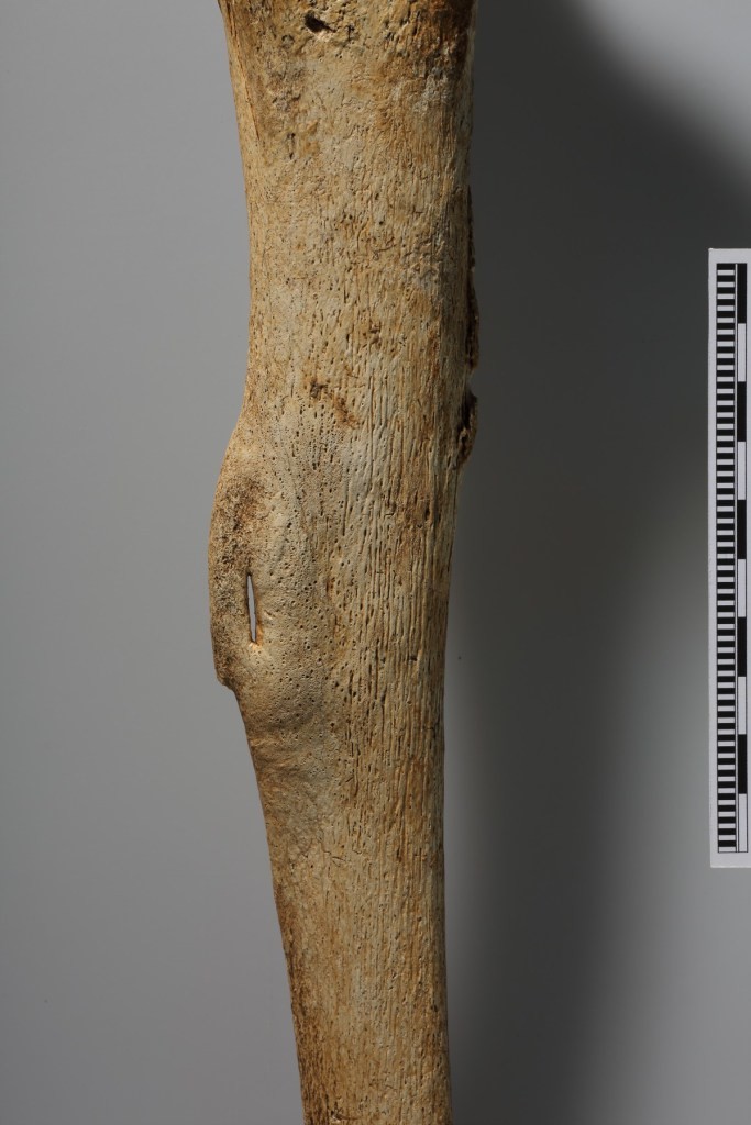 Ampio dettaglio sulla neo-formazione ossea sul margine esterno della tibia destra (Foto: Niki Gail, OEAI, the Austrian Archaeological Institute).